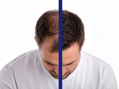 art beauty clinic otoplastica