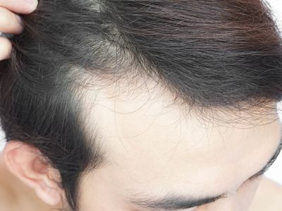 art beauty clinic otoplastica